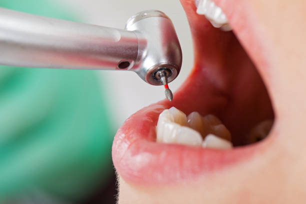 Best Cracked Tooth Emergency Dentist  in Wind Gap, PA